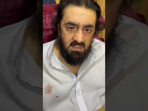 Hafiz Hamdullah Latest Video Message After Blast | حافظ حمداللہ کا ویڈیو پیغام