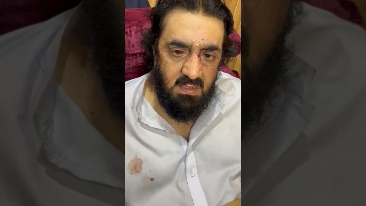 Hafiz Hamdullah Latest Video Message After Blast | حافظ حمداللہ کا ویڈیو پیغام