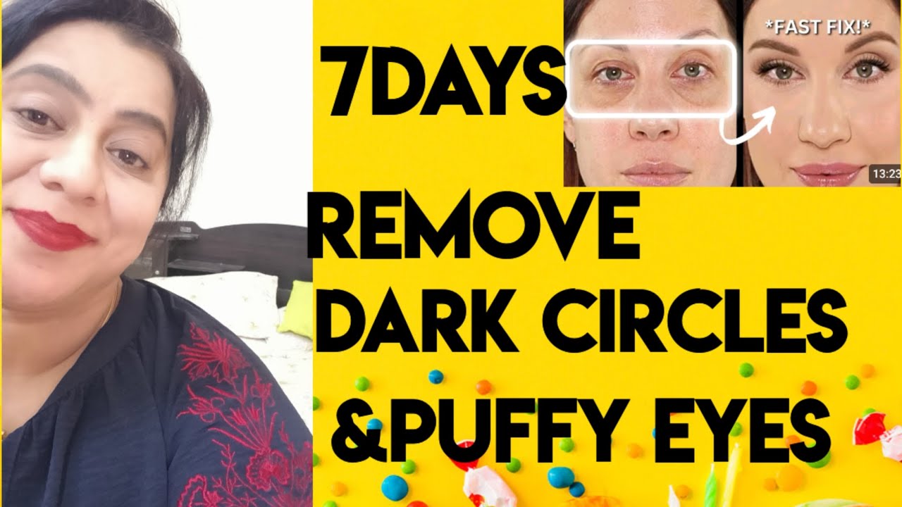 In 7 days 💕 Remove DARK CIRCLES, PUFFY EYES Naturally ||100%  Results 💫