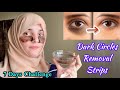 How to Remove Dark Circles Naturally in 7Days  || Homemade Dark Circles Removal Strips