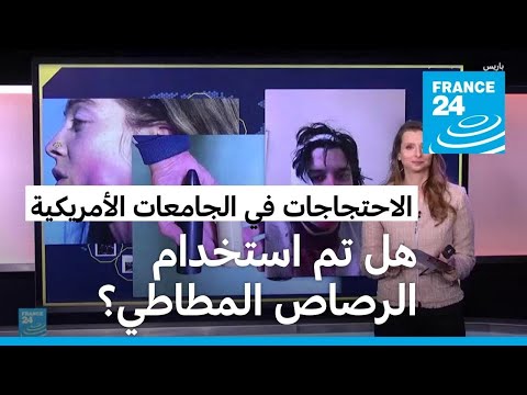             ɿ   24
 - نشر قبل 4 ساعة