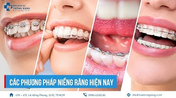 Các Phương Pháp Niềng Răng Hiện Nay | Braces