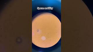 Sperm motility