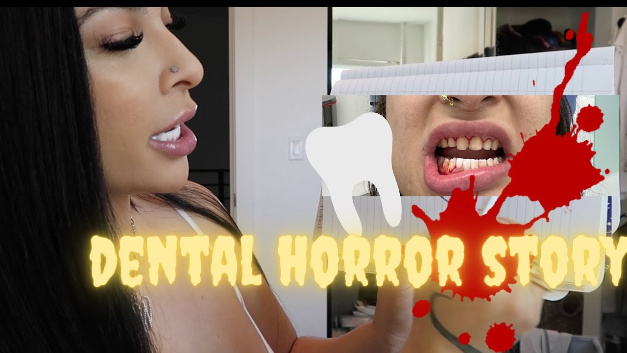 MY VENEER HORROR STORY *SMILEDENTALCENTER32 RUINED MY LIFE* EMOTIONAL