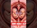 A Sign of Twin Babies | general awarness of twins pregnancy #pregnancy #delivery #twinsbabies