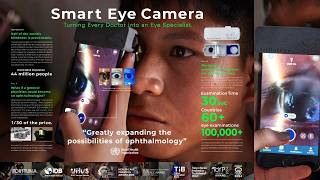 OUI - Smart Eye Camera (Case Study) | Campaign