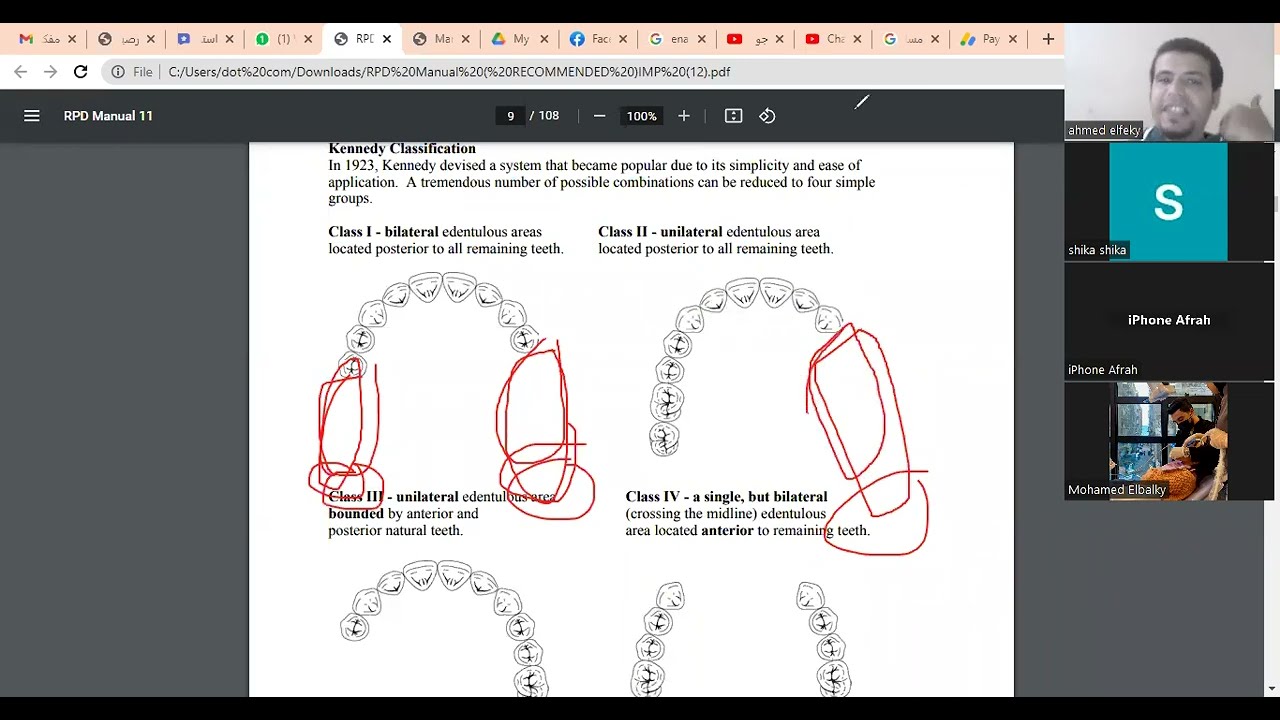 اهم جزء في البروستو مع الرسم التوضيحي مهم#برومترك_قطر #برومترك_دبي #برومترك_اسنان #برومترك_السعوديه