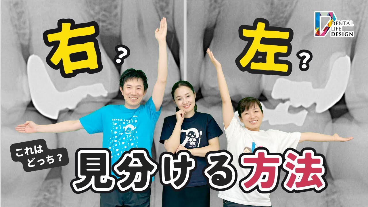 【咬翼法フィルムを見た時に右側の画像か左側の画像か判断する方法について教えてください】教えて相宮先生【歯科衛生士が知っておきたいデンタル撮影のポイント】/相宮秀俊先生