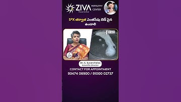 s*x తర్వాత ఎంతసేపు | How Much Time To Lay Down After Intercourse | Dr C Suvarchala | Ziva Fertility
