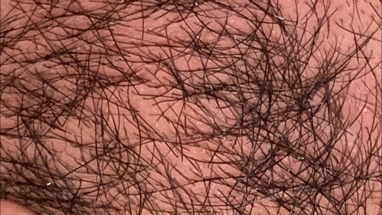 ASMR ingrown satisfying long hair video 