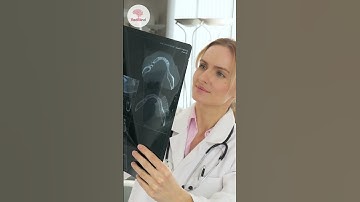 Can AI Really Save Lives in Healthcare? 🏥🤖 | The Future of Medicine