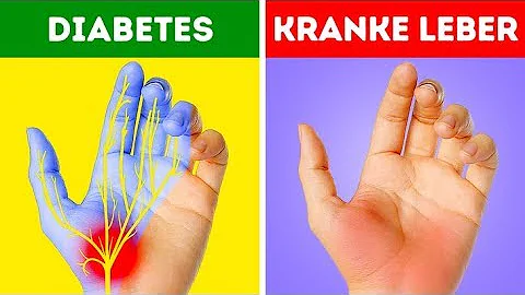 Ist eine geschwollene Hand gefährlich?