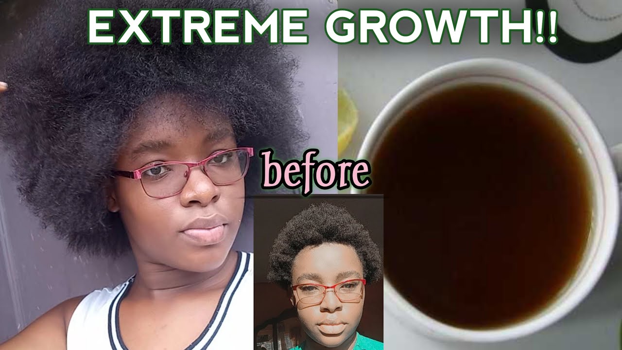 Green Teas for Hair Growth 5 Teas to Drink For Extreme Hair Growth