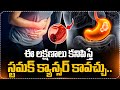 ఈ లక్షణాలు కనిపిస్తే స్టమక్ క్యాన్సర్స్ కావచ్చు.. | Stomach Cancer Signs &amp; Symptoms | Suman TV