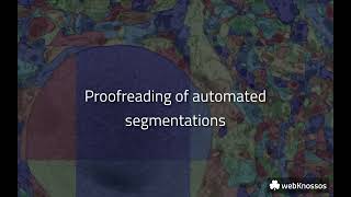 webKnossos - Proofreading of automated segmentations