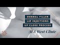 Up Close Process: Dermal Filler Lip Injections on Amanda | 8 West Clinic, Vancouver