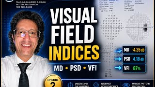 Visual Field Indices Explained l MD، PSD، VFI and Reliability l Episode 2 