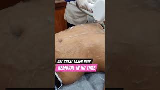 Full Body Laser Hair Removal in Delhi laserhairremoval laserhairremovaltreatment lasertreatment