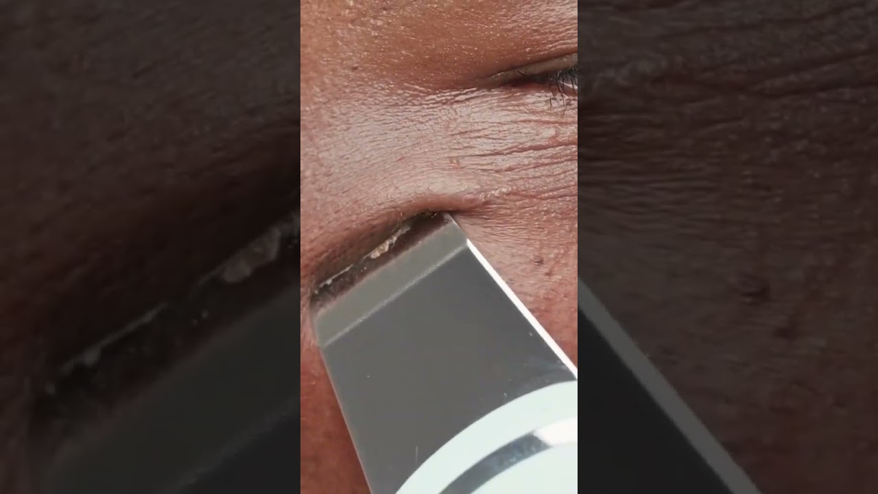 Discover the magic of LELA's 4-in-1 Ultrasonic Facial Skin Spatula! 🌟  