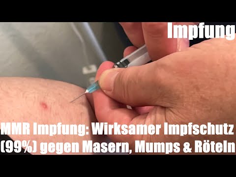 Video: Tut die mmr-Impfung weh?