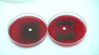 Optochin test for Strep pneumoniae