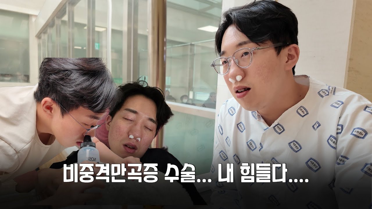 코를 뜯어고친 남자의 수술 전과 후