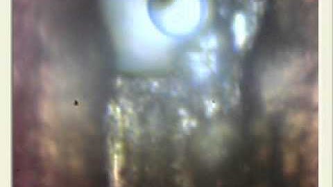 Synvir Inc - Emulsion PCR droplet generation