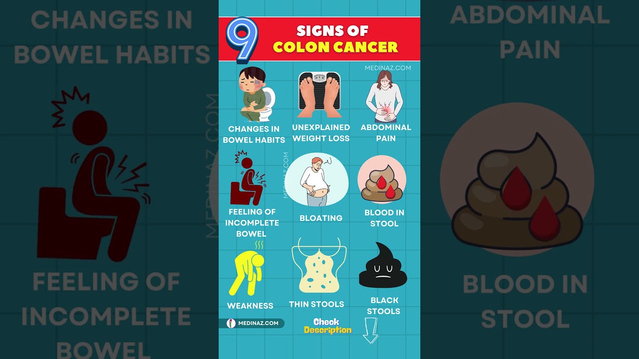 10 Early Signs Of Colon Cancer That Could Save Your Life