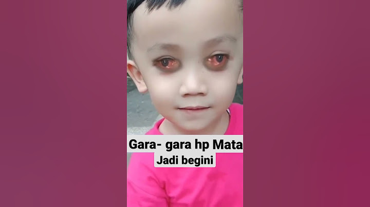 Mata bocil rusak gara2 hp