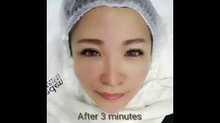 Medical Grade Skin Peel Dr Daniel Chang Korean Skin Clinic