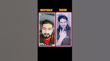 MEWING TIME 🤫#looksmax #model #looksmaxx