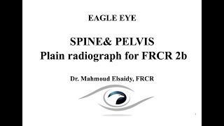 02 Spine& pelvis plain radiograph for FRCR 2b by Dr.Mahmoud Elsaidy