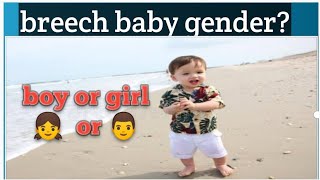 breech baby boy or girl || during pregnancy maher experience ||