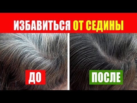 Избавиться От Седины можно, если знать эти нюансы