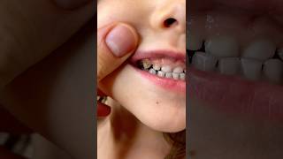 🦷Знаю чем очистить темный налёт на зубах! Озон: 1282425204 #распаковка #обзор #wildberries #находки