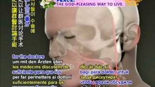 Report French surgeon carries out first-ever total face transplant