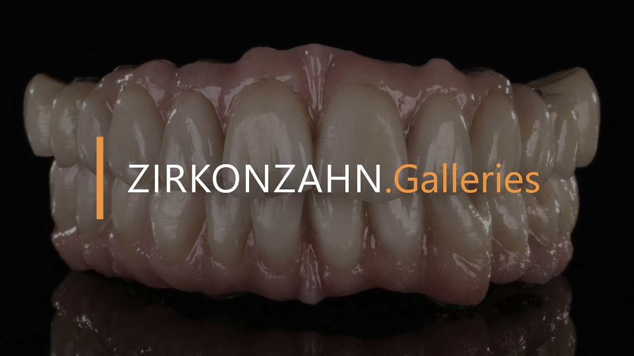 Prettau® restorations made with PlaneSystem® & Face Hunter Zirkonzahn