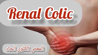 Renal colic المغص الكلوى فى الطوارئ