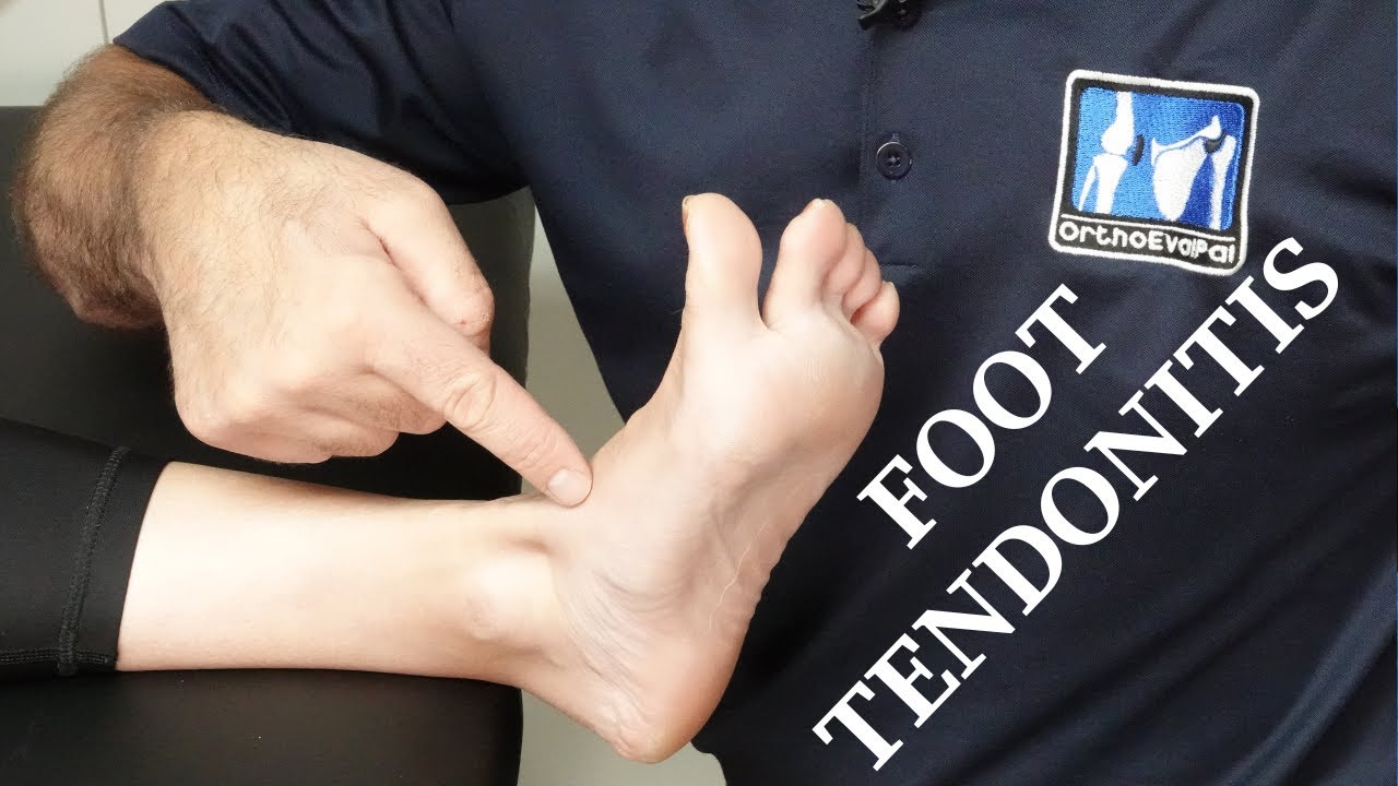Tibialis Anterior Tendonitis (Top of the Foot Pain)