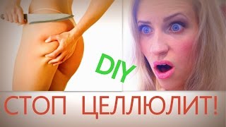 Как ИЗБАВИТЬСЯ ОТ ЦЕЛЛЮЛИТА дома? СТОП ЦЕЛЛЮЛИТ! Моё средство РАБОТАЕТ! Убираем целлюлит! DIY(Мой instagram-http://instagram.com/elenatop27 ❤ ❤Моя группа в контакте-https://vk.com/elenatop27❤ ❤ Мой email: elenatop27@gmail.com ❤Мой ..., 2014-08-21T12:03:46.000Z)