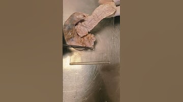 Duodenum & Pancreas #shorts #youtubeshorts #shortsvideo #ytshorts #viralvideos #anatomy #medical