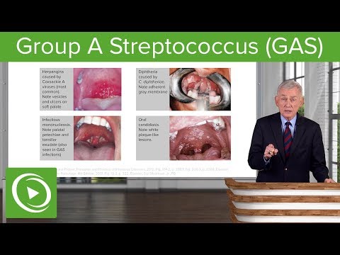 Видео: Група A Strep - Стрептоко гърло - За клиницистите - ГАЗ