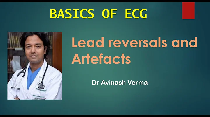 Lead reversals and Artefacts Dr Avinash Verma ECG ...