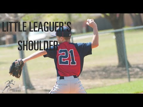 Little Leaguer’s shoulder: Risk factors, treatment and prevention of this common shoulder injury