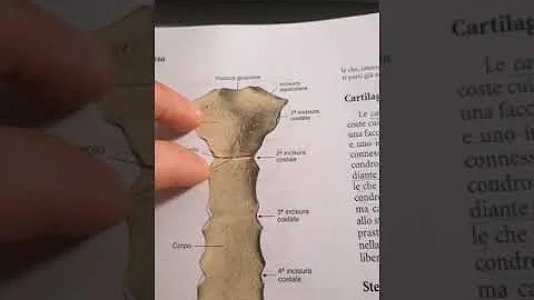 Quando ti fa male lo sterno?