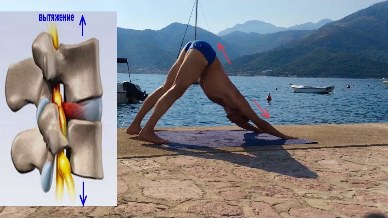 ВЫТЯЖЕНИЕ ПОЗВОНОЧНИКА ПРИ ГРЫЖЕ, СКОЛИОЗЕ. КОМПЛЕКС УПРАЖНЕНИЙ - YouTube