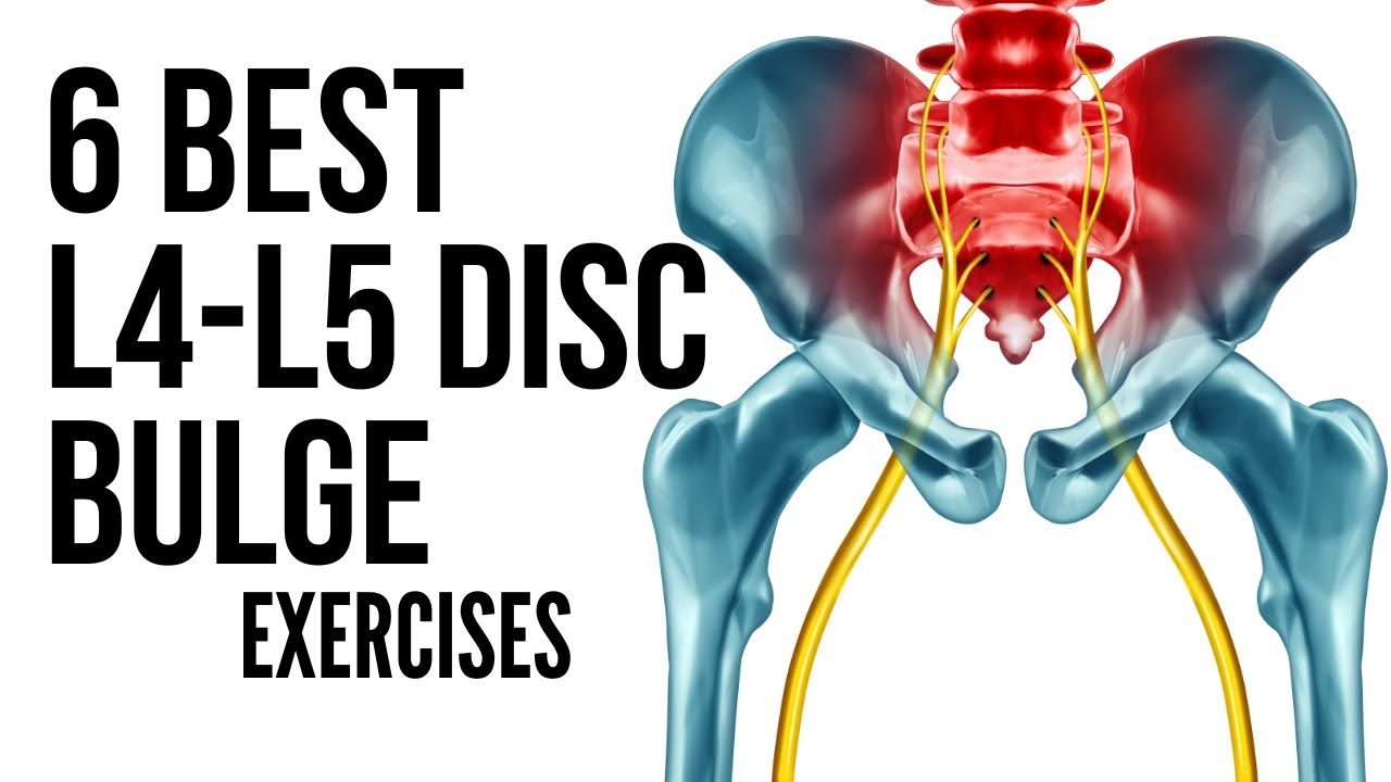 6 Best L4 L5 Disc Bulge Exercises in Hindi to avoid