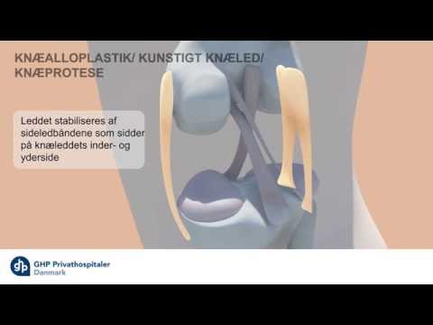 Video: Hvad er forskellen mellem belastning og vægt?