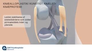 Overbelastede knæ? Information om indsættelse af knæprotese - GHP Privathospitaler