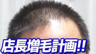 私はまだあきらめていない！頭皮に届け！！妻の願い！